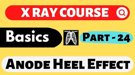 Anode Heel Effect | Part - 24 | X Ray Course | Doctor Inside Academy - YouTube