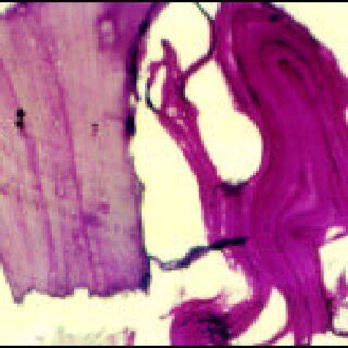 -Periodic acid-Schiff positive folded lamellae of Echinococcus ...