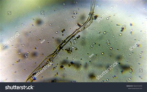 Aspergillus Niger Mold Under Microscope Stock Photo 1892310379 ...