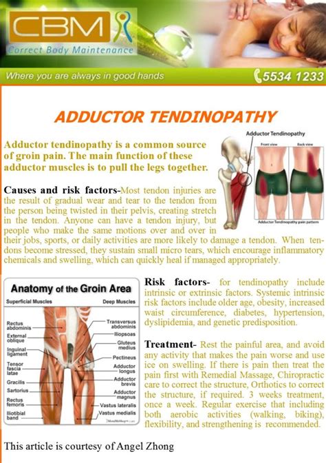 Adductor Tendinopathy | Correct Body Maintenance