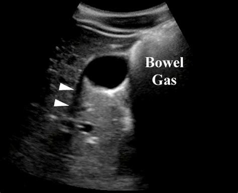 Physics Images | Emergency Ultrasonography