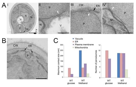 Peroxisome membrane contacts in H. polymorpha. (A) EM analysis of thin ...