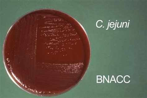 Campylobacter jejuni - wikidoc