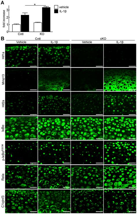 Regulation of cartilage degradation by HIF-1α. (A) Amount of... | Download Scientific Diagram