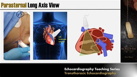 Lecture 2 - Transthoracic Echocardiography Part 1 - YouTube