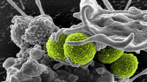 MRSA in Nursing Homes | Symptoms of MRSA in Elderly Residents ...