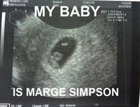 Funny Things Detected by Ultrasound (20 photos) | KLYKER.COM