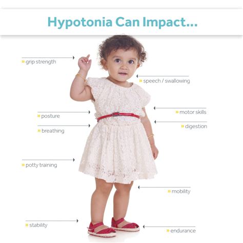 Hypotonia - What Family and Friends Need To Know | Surestep