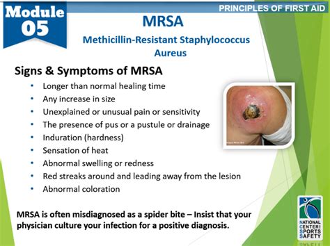 15-mrsa2 – National Center for Sports Safety