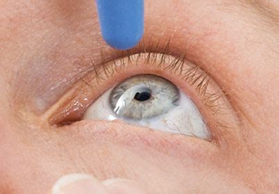 eye-care-Glaucoma – Cynthia Kiernan OD