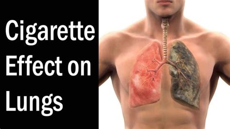 Cigarette Effect on Lungs - How to Quit Smoking - Health Effects