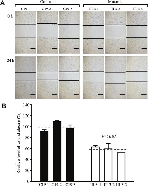 Wound healing assay. (A) Representative images of wound healing assay... | Download Scientific ...