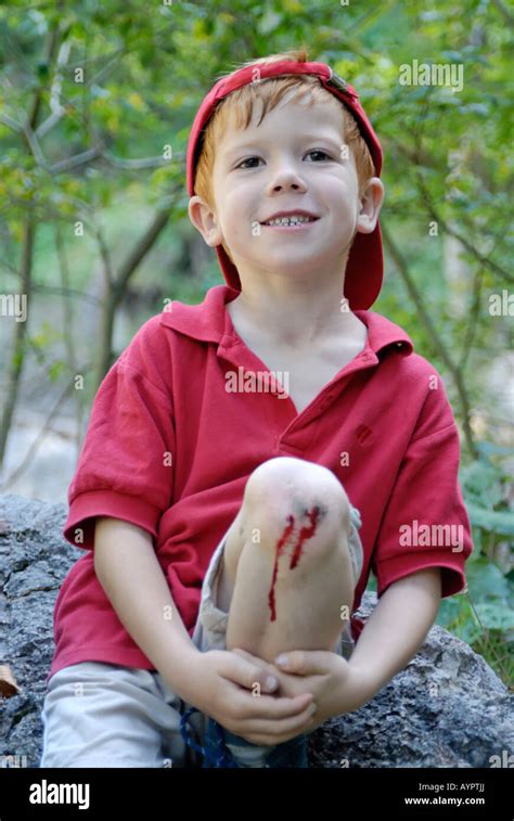 Boy with injured knee, bleeding Stock Photo - Alamy