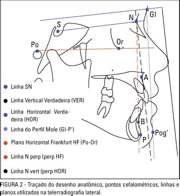 frankfort horizontal plane - Google 검색 | 검색