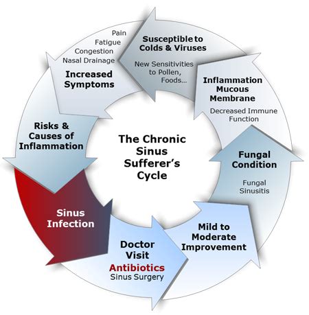 Amabilidad Armstrong filósofo candida sinus treatment Crítico Cien años Miserable