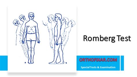 Romberg Test Interpretation Overview 2024