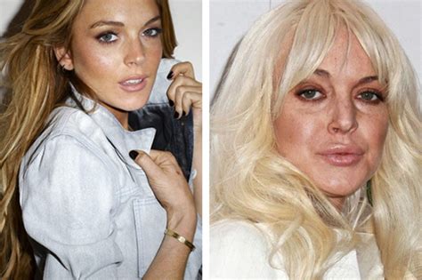 Shocking Photos of Celebrities Before and After Drugs - LOLSPOT