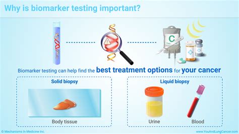 Slide Show - Understanding Biomarker Testing in Non-Small Cell Lung Cancer