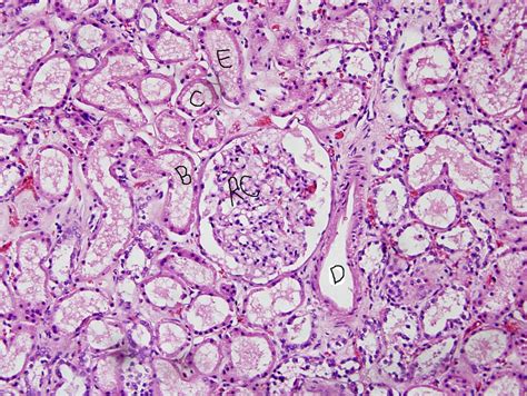 Kidney under microscope - The Student Room