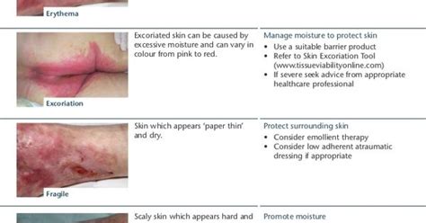 excoriated skin pictures - Google Search | Wound Care | Pinterest ...