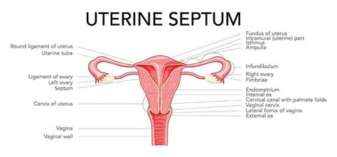 Septate Uterus (Uterine Septum): Symptoms Treatment, 59% OFF