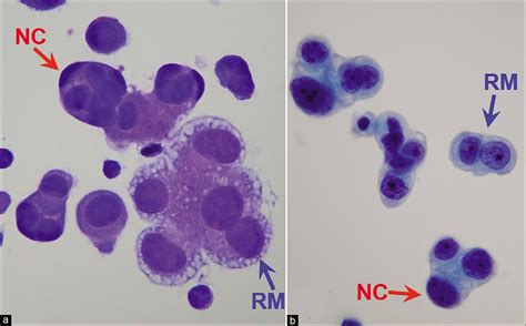 The panorama of different faces of mesothelial cells - CytoJournal