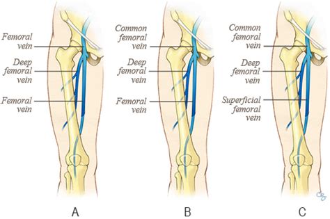 Superficial Femoral Vein Anatomy