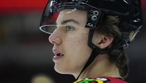 Connor Bedard resumes skating Monday, just seven days after jaw surgery ...