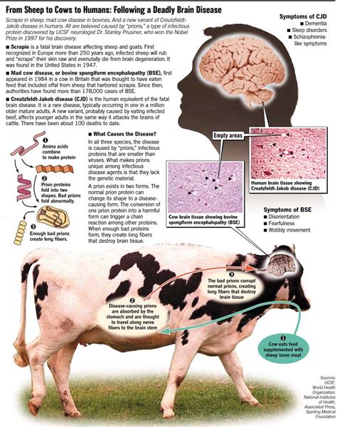 Mad Cow Disease In Humans Brain