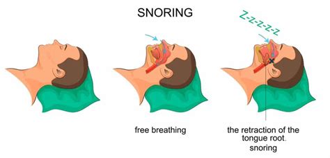 Best Anti Snoring Pillows: Top 5 Pillows to Help with Snoring for 2019