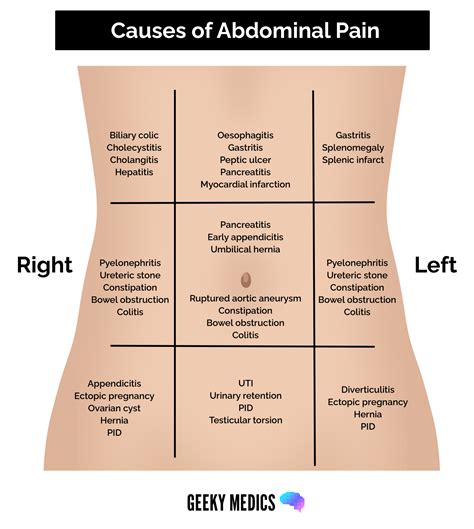 Abdominal Pain History Taking - OSCE Guide | Geeky Medics