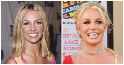 Why Does Britney Spears Have a Gap Tooth? Find out Here!