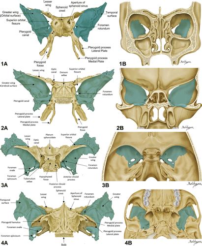 1.1.2.1: The Sphenoid Bone: Greater Wing and Sinus | RadAnatomy Wiki | Fandom