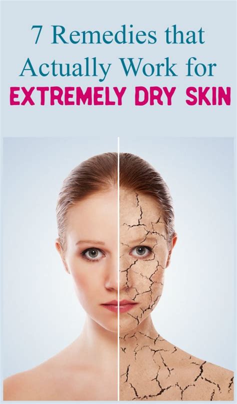 7 Tried & True Ways to Combat EXTREMELY Dry Skin - Pretty Opinionated