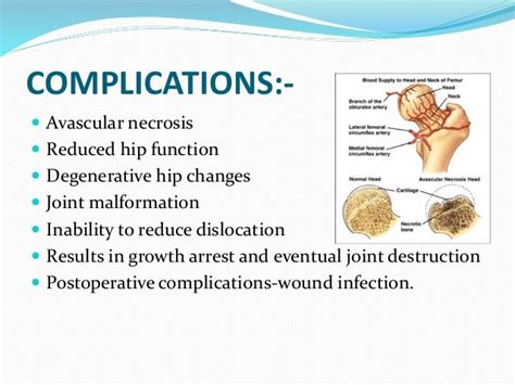 Hip dislocation