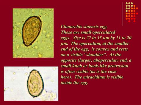 Clonorchis Sinensis Egg Slide