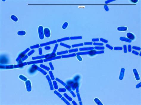 Fun With Microbiology (What's Buggin' You?): Geotrichum candidum