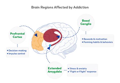 How does addiction affect the brain? » Ask Our Doctors (by JourneyPure)