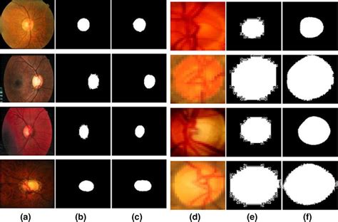 (a) Optic Disc Test Image (b) Groundtruth image (c) Predicted Optic ...