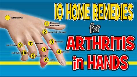 10 Home Remedies for Arthritis in Hands - Pain Relief Diet - YouTube