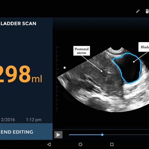 Bladder Scan Mode D'emploi / BioCon-500 Bladder Scanner