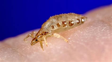 Body Lice Symptoms, Diagnosis, and Treatment | Everyday Health