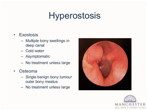 External and middle ear disease for g ps