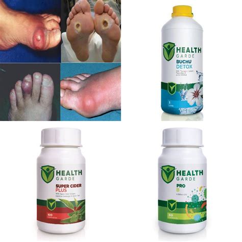 Healthgarde Gout Treatment Pack