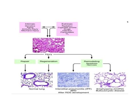 Anatomy and Physiology of Lung Interstitium