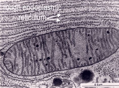 Why Can T You See Ribosomes Through a Light Microscope