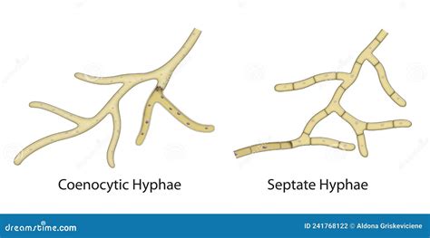 Fungal Cell Structure. Fungi Hyphae With Septa Vector Illustration ...