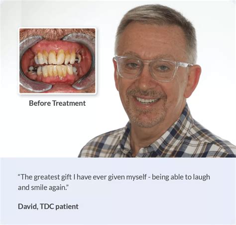 David's Smile in a Day - TDC Dental Implants Centre