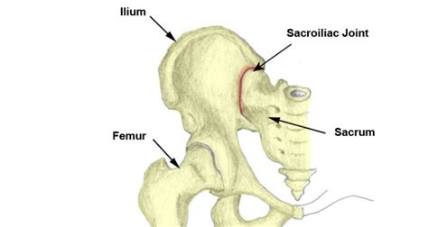 Diastasis Sacroiliac Joint