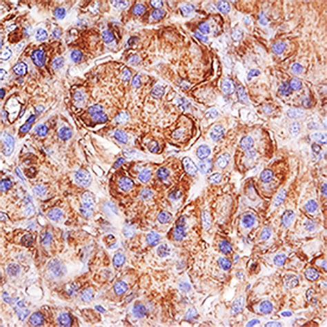 Trypsin Antibody (PA5-47544)